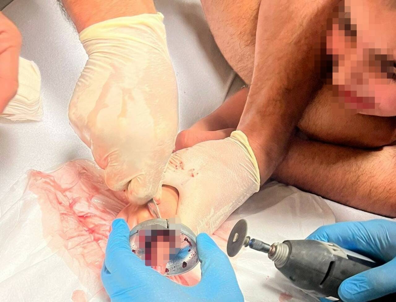 Bursa’nın İnegöl ilçesinde parmağı çeşme aynasına sıkışan çocuğu itfaiye ekipleri