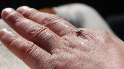 Erzurum Sağlık İl Müdürlüğü uzmanları; Kırım Kongo kanamalı ateşinin (KKKA),