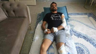 Hatay’da otomobille, motosikletin çarpışmasıyla yaşanan kazada, motosikletteki 2 kişi yere