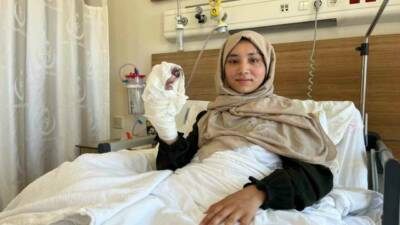 Çin zulmü altındaki Doğu Türkistan’da 7 aylıkken eline kaynar su