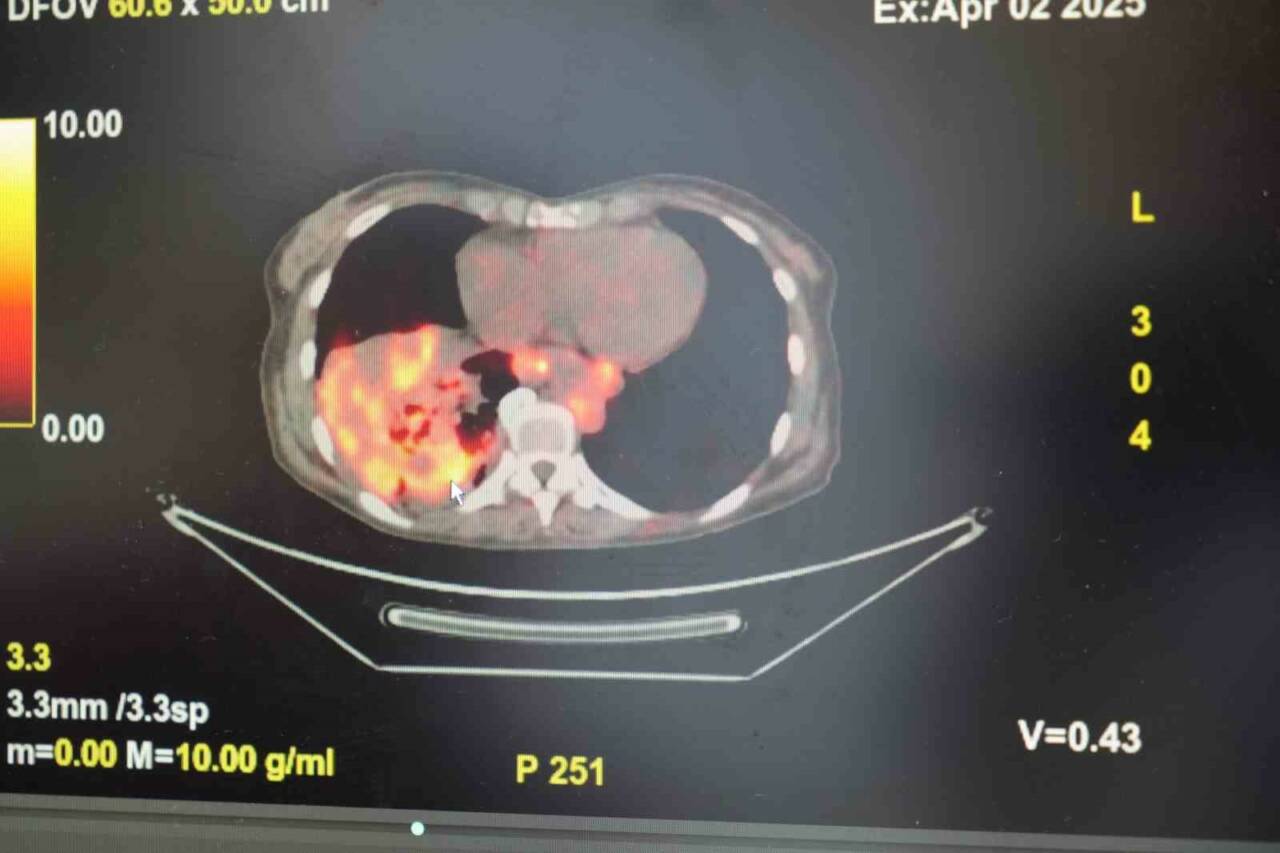 Göğüs Hastalıkları Uzmanı Prof. Dr. Şevket Özkaya, son yıllarda sigara